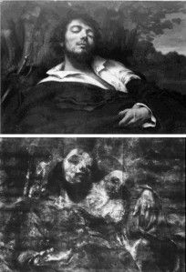 Courbet, l'homme blessé (Orsay), radiographie